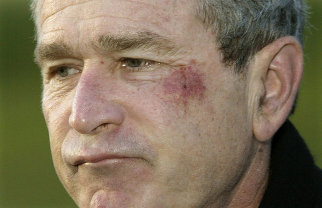 Betisorul de ureche al lui Basescu si covrigelul lui Bush jr. Cele mai stupide accidente suferite de liderii lumii