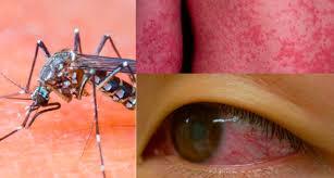 Începe isteria? Zona din România în care a fost identificat țânțarul vector pentru transmiterea Zika