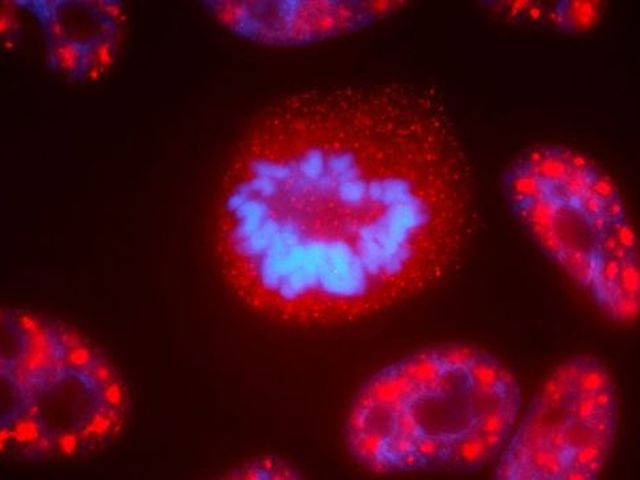 Descoperire de proporții legată de cancer. ''Timp de 60 de ani am crezut asta''