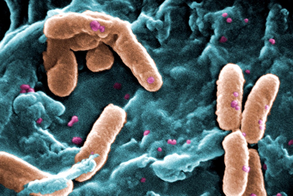 O bacterie rezistentă la orice antibiotic a fost descoperită în apele din Rio de Janeiro