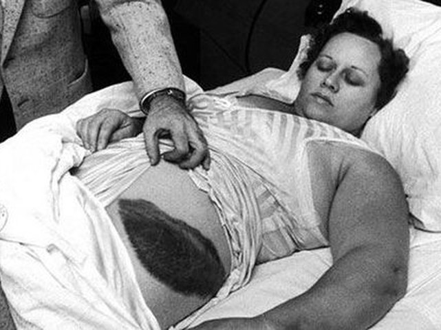 Ann Hodges, singura persoană lovită de un meteorit