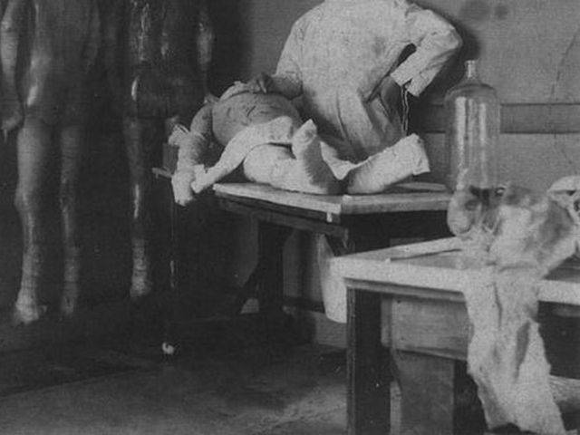 După 30 de ani de stat într-o pungă, rămășițele lui Joseh Mengele, ''îngerul morții'', au început să fie examinate. Descoperire șocantă a cercetătorilor: ''Nu am mai văzut asta!''