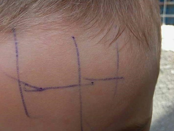 Situație incredibilăla o grădiniță din Gorj. Copil de 4 ani, scris cu pixul pe față pentru a fi pedepsit