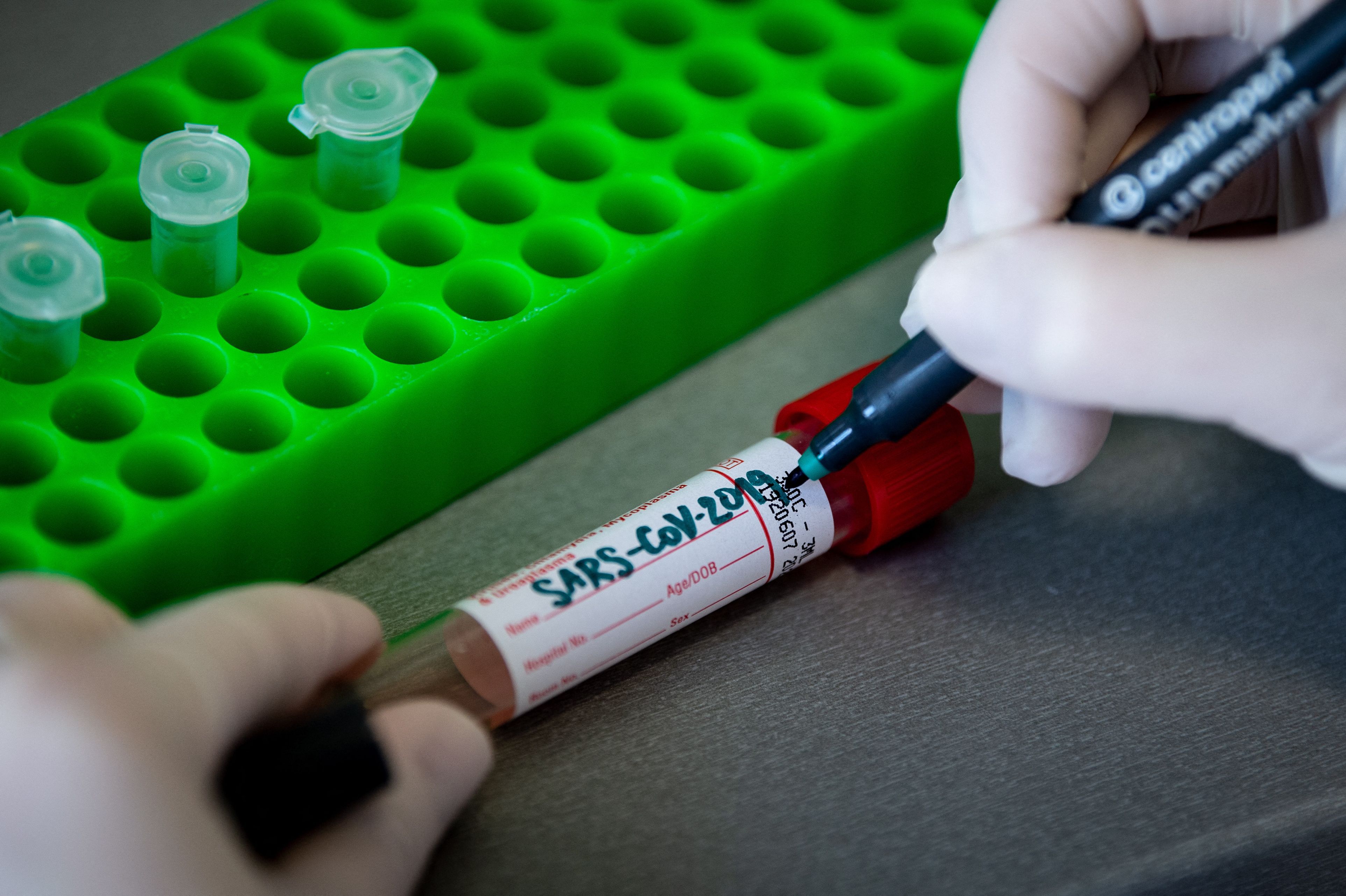 De ce numărul de cazuri cu coronavirus este mult mai mic în țările în curs de dezvoltare din Europa decât în statele vestice?