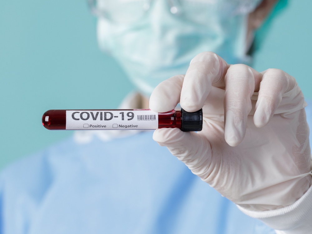 Numărul oficial de români care au murit, în străinătate, din cauza noului coronavirus, de la debutul pandemiei