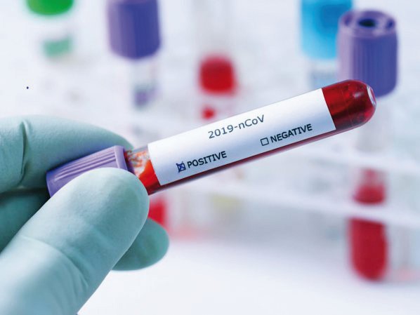 Grecia cere test COVID-19 pentru toți românii care intră pe teritoriul său