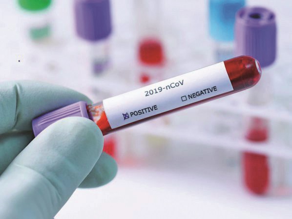 Ce ne arată rezultatele testelor de anticorpi după vaccinare?