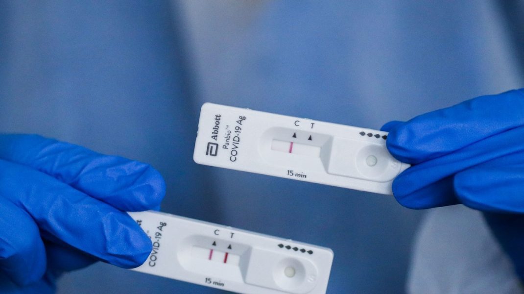 Cum îți dai seama dacă ai fost infectat cu coronavirus, dar ai fost asimptomatic