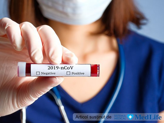 Ce tip de test este recomandat pentru a afla dacă avem anticorpi specifici SARS-CoV-2. Explicațiile unui medic specialist