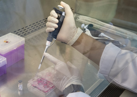 Noi progrese în ceea ce privește inversarea procesului de îmbătrânire a celulelor. Bolile bătrâneții ar putea fi prevenite