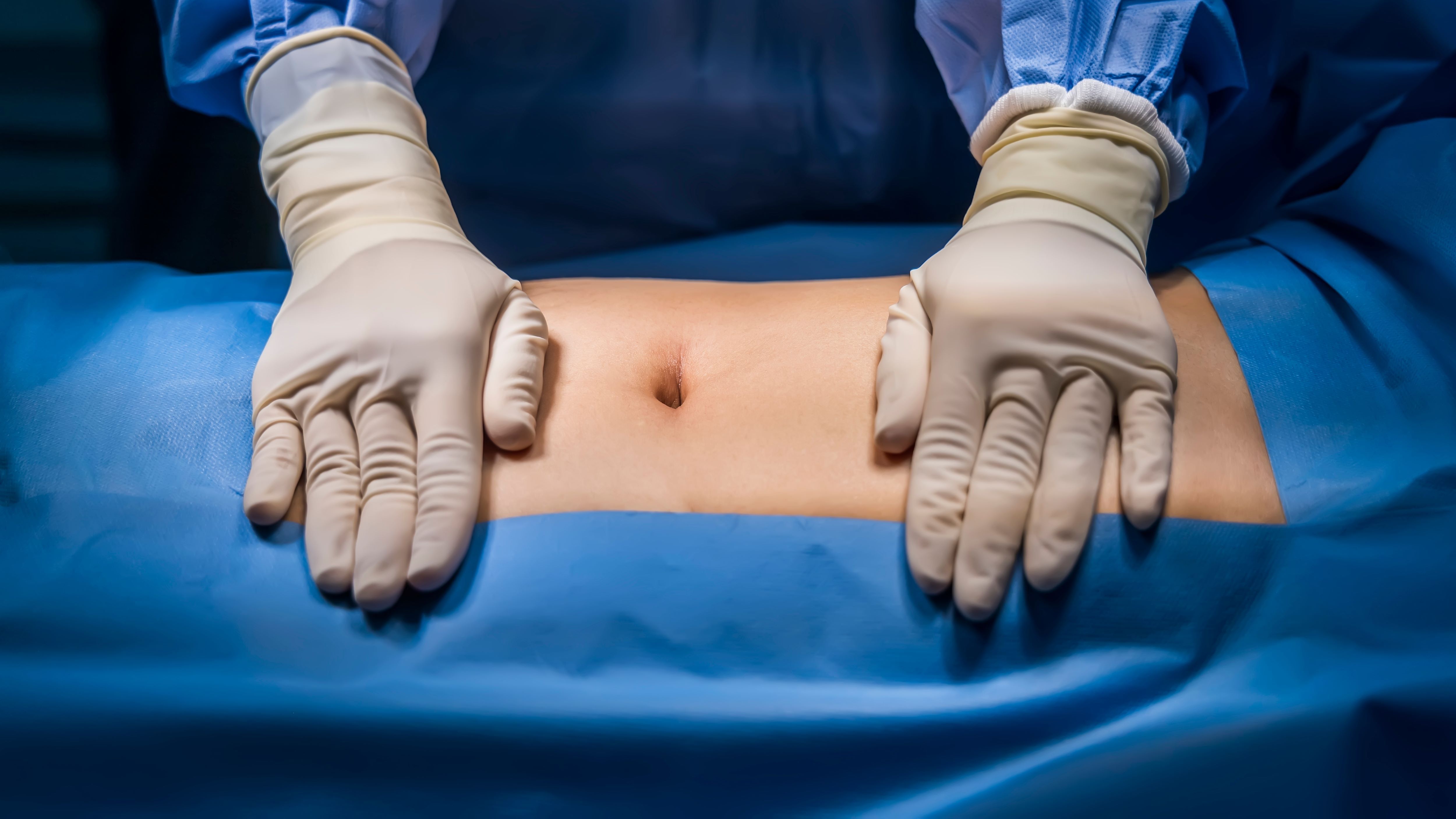 Care este singura metodă eficientă de tratament pentru hernia inghinală?