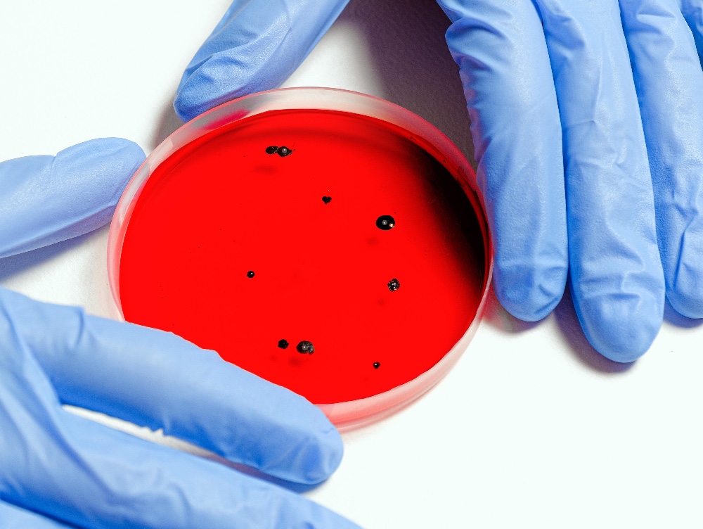 Infecții si dececesele cauzate de virusul West Nile continua sa creasca in Romania. Care sunt ultimele cifre