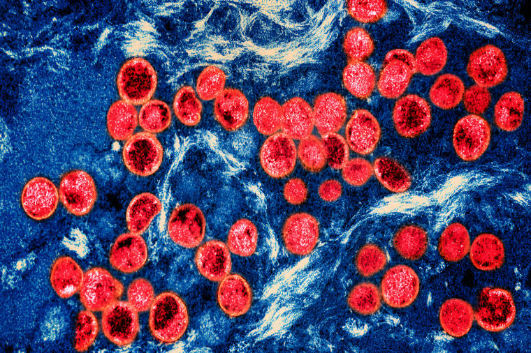 Rază de speranță în lupta cu HIV. Un nou vaccin experimental are rezultate promițătoare