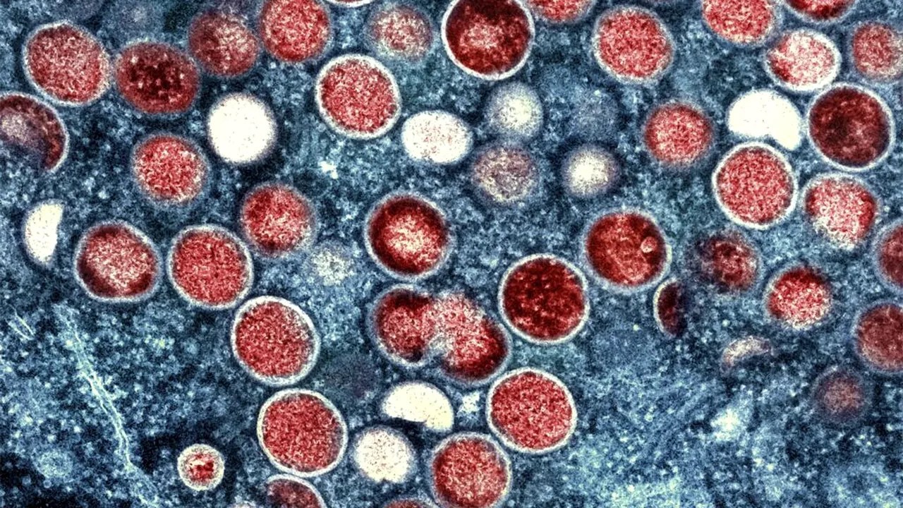 Pentru prima dată în România, a fost confirmată prezența virusului POX