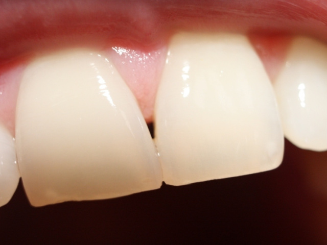 De ce a vândut antreprenorul Dan Drăghici businessul de tehnică dentară? „Am decis să iau un frate mai mare lângă mine”